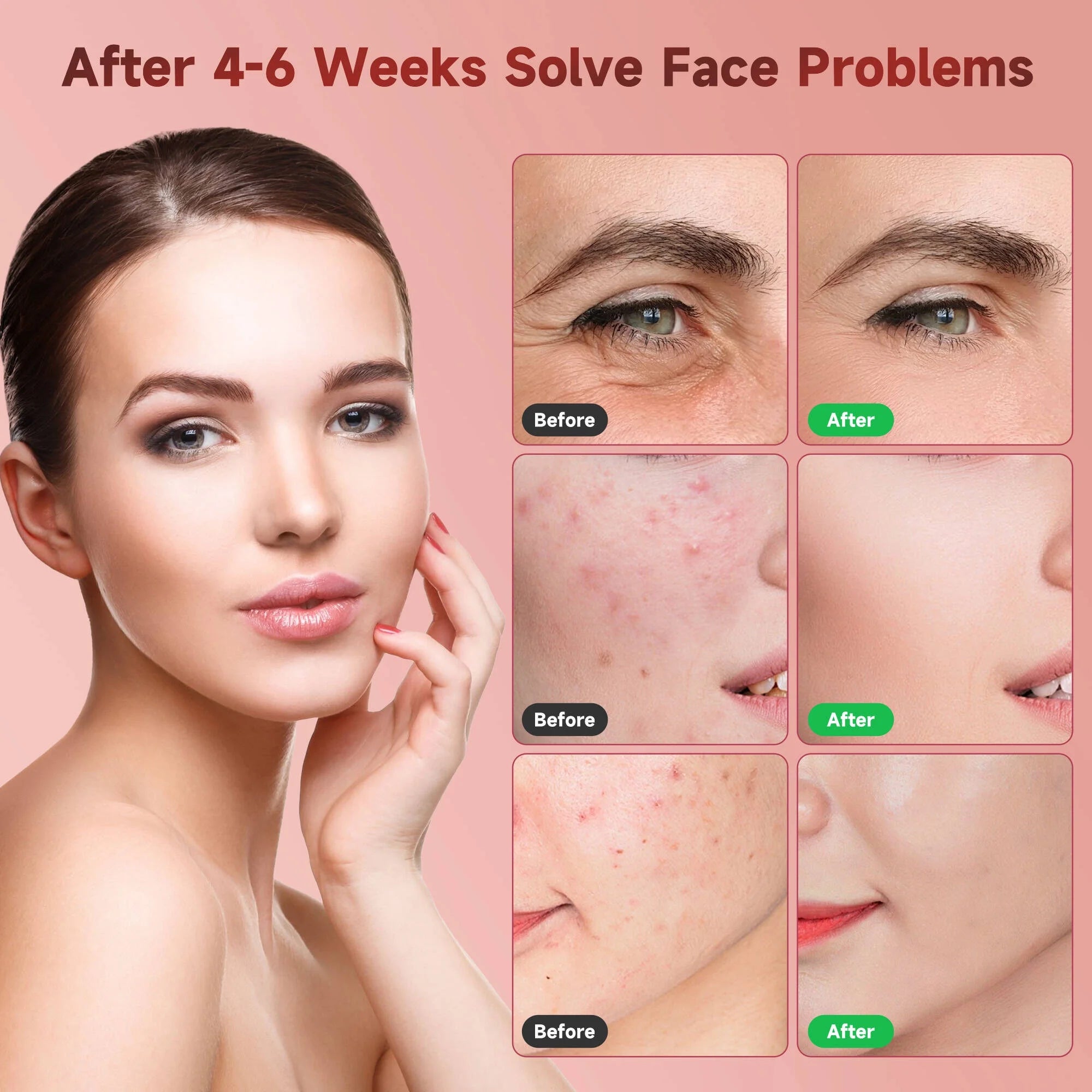 Morfone LED Face Mask: 4 Light Modes & Timer for Skincare